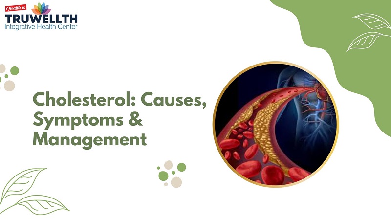 Cholesterol